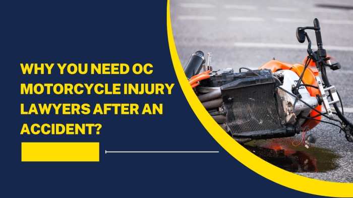 Why You Need OC Motorcycle Injury Lawyers After an Accident? - Latest ...