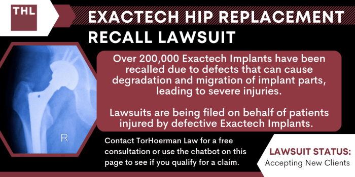 Exactech Hip Replacement Recall Lawsuit