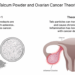 Talcum Powder-Long-Term Use Linked to Both Mesothelioma and Ovarian ...