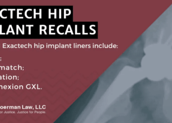 Exactech Lawsuit [2026 Update] | Exactech Recall Lawsuits